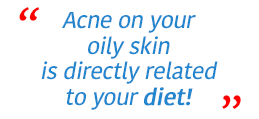Oily skin, Get rid of Acne FOREVER Part 4